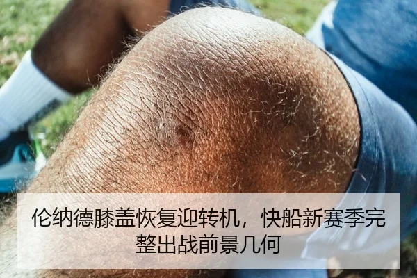 伦纳德膝盖恢复迎转机，快船新赛季完整出战前景几何